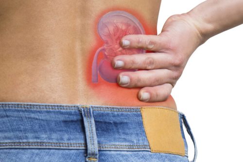 Kidney and low back pain